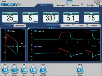 eVent Medical | PRVC Monitoring