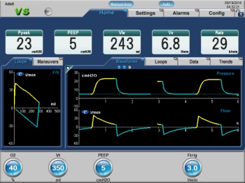 eVent Medical | PRVC Monitoring